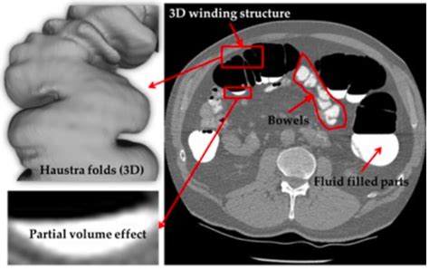 Biomedical Image Segmentation