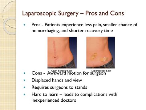 Ppt Robot Assisted Laparoscopic Surgery Da Vinci System Powerpoint