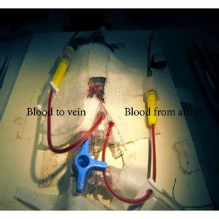 The Mouse Extracorporeal Circulation Circuit Mice Were Anesthetized