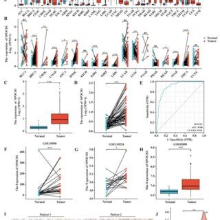 Mrna And Protein Expression Levels Of Spocd In Pan Cancer And