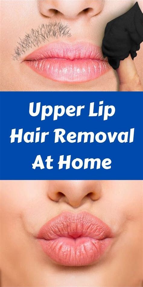 Upper Lip Hair Removal At Home Naturally Permanently Thomas Yespire