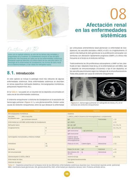 Afectación renal en las enfermedades sistémicas Full ciencia uDocz