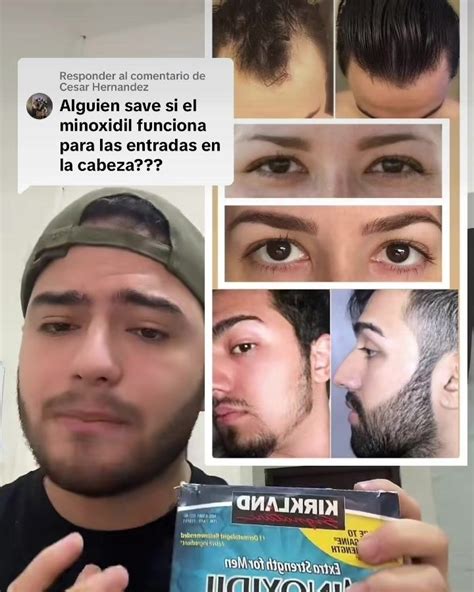 El Mejor Tratamiento Para El Crecimiento De Cabello Cejas Y Barba