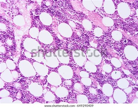 Histology Human Tissue Show Fibrous Cartilage Stock Photo 649290409 | Shutterstock