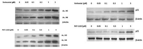 Effect On Histone Acetylation Status And P21 Cipwaf1 Induction By