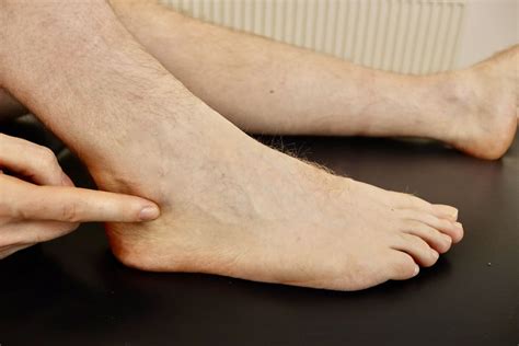 Podiatrists For Peroneal Tendon Surgery In Chestermere