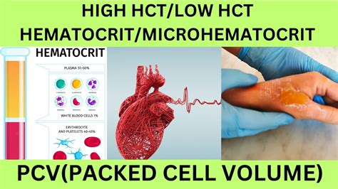 Hematocrit Packed Cell Volume Why Is It Important Normal Ranges Causes