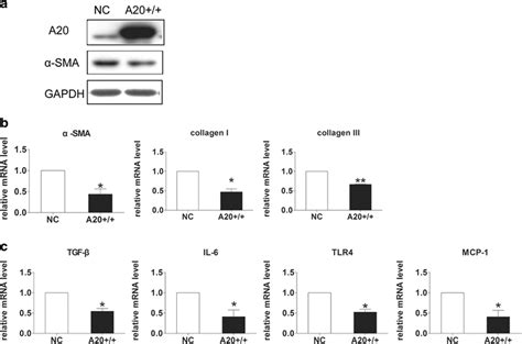 A20 Overexpression Inhibited Lx 2 Cells Activation And Attenuated