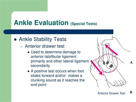 Ppt Foot And Ankle Seminar Powerpoint Presentation Free Download