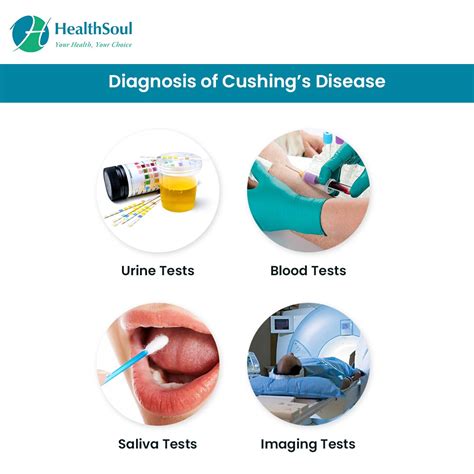 Cushings Disease Symptoms Diagnosis And Treatment Healthsoul