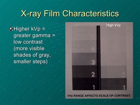 03 Xray Film Etc