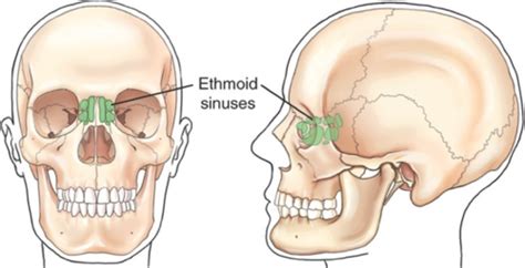 Chapter Paranasal Sinuses Some Special Projections Flashcards