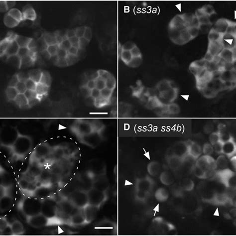 Starch Granule Morphology In Mature Rice Seeds A Scanning Electron