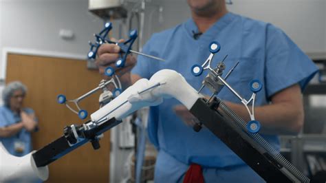 Lewisgale Using Robotics Assisted Knee Surgery