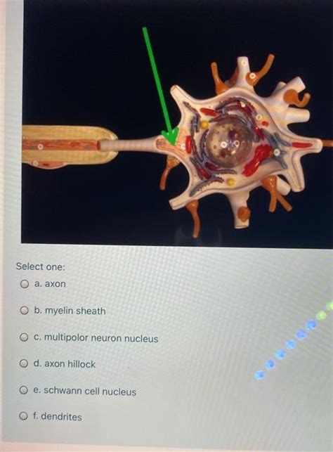 Solved Be Select One O A Thalamus O B Anterior Commissure Chegg