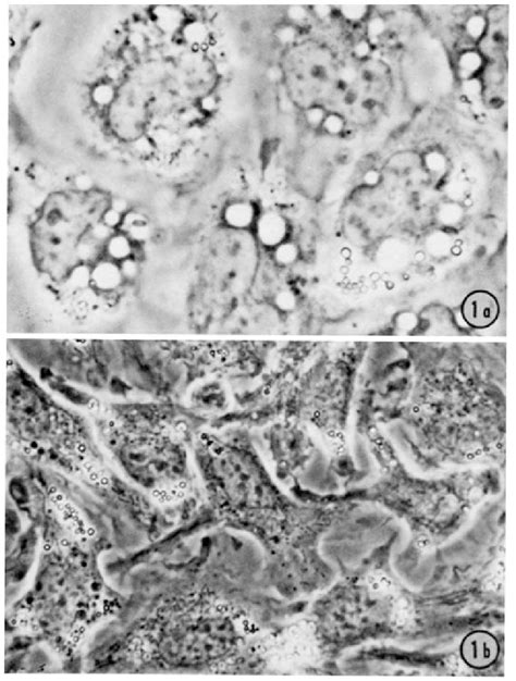 Phase Contrast Photomicrographs Of Mouse Peritoneal Macrophages