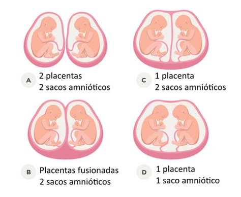 ¿cuál Es La Diferencia Entre Gemelos Y Mellizos Todo Para Los Bebés