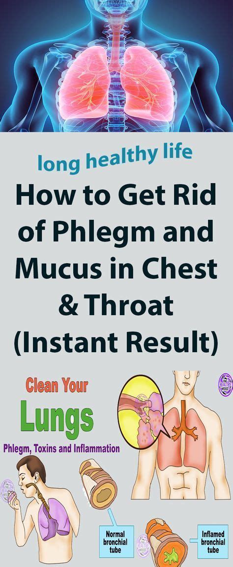 How To Get Rid Of Phlegm And Mucus In Chest Throat Instant Result