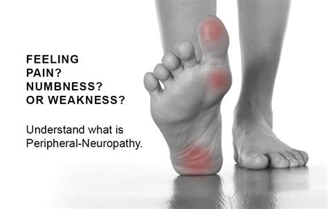 Peripheral Neuropathy Nona Medical Arts Tingling And Numbness