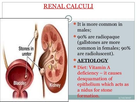 Diseases Of Excretory System