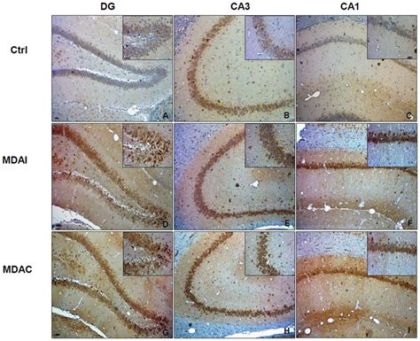 Levels And Preferential Localization Of Hsp60 In Control Non Stimulated