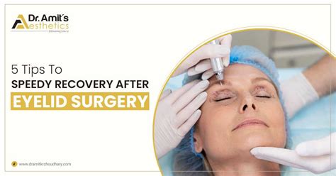 5 Tips To Speed Recovery After Eyelid Surgery