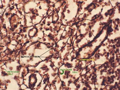 Histology Lab September 9 Connective Tissue Flashcards Quizlet