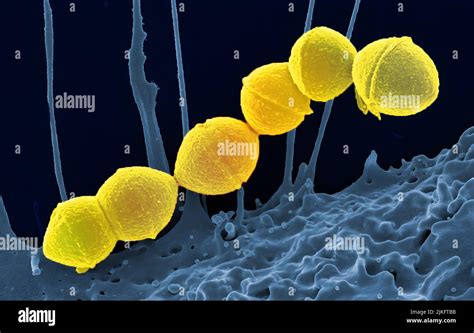 Streptococcal a bacteria hi-res stock photography and images - Alamy
