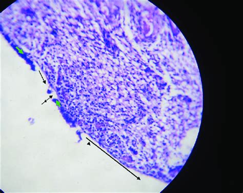 Photomicrograph Of The Uterus Of Cattle Naturally Infected With Download Scientific Diagram