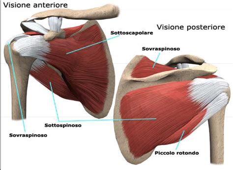 Tendinopatia Calcifica Della Cuffia Dei Rotatori Patrizio Sale