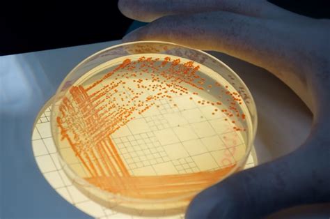 Serratia Marcescens - The Definitive Guide | Biology Dictionary