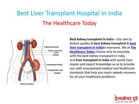 Ppt Best Liver Transplant Hospital In India Powerpoint Presentation