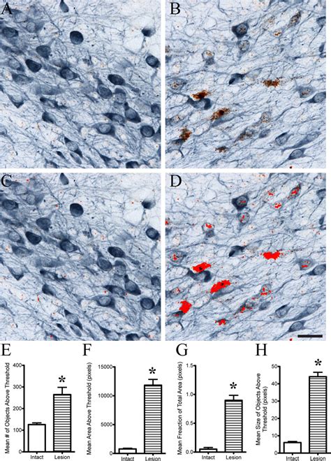 Semi Quantitative Regional Analysis Of Ish Signal In Dual Labeled