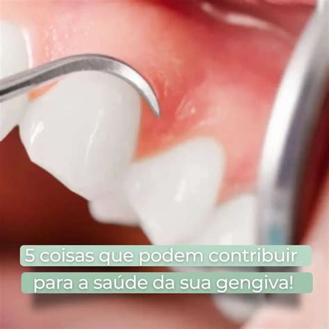 5 Coisas Que Podem Contribuir Para A Saúde Da Sua Gengiva Ora