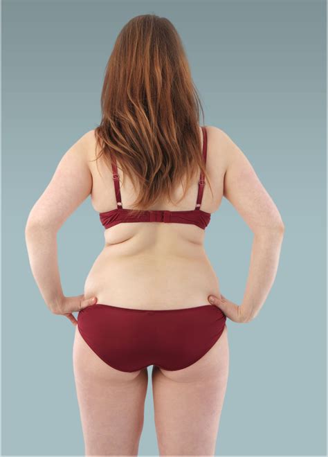 Bikini Back Fat