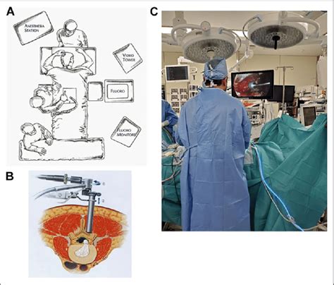 A A The Layout Of Equipment B METRx Endoscopic System With The