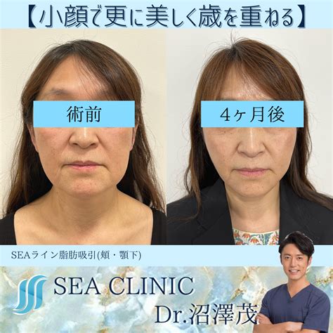 小顔で更に美しく歳を重ねる Sea Clinic −シークリニック 銀座― 理想を叶える小顔治療