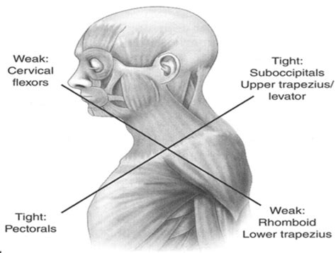 Week 1 Posture Lumbar Biomechanics Lumbar Hx Dx Gait Flashcards