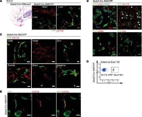 Figure From Gata Dependent Organ Specific Endothelial