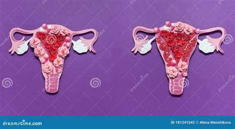 The Women`s Reproductive System The Concept Of Endometriosis Of The