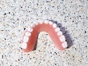 Dentadura postiza sin paladar Descripción ventajas y características