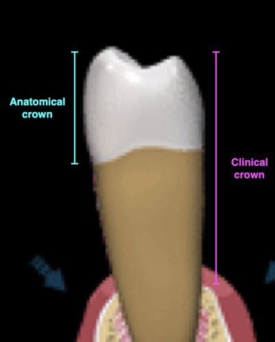 Selection Of Abutment Teeth Flashcards Quizlet