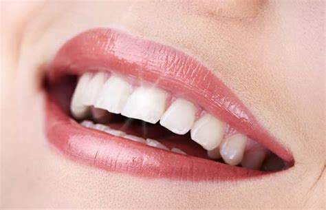 3 Procedures From a Cosmetic Dentist - Dental Smiles of Willow Glen San ...