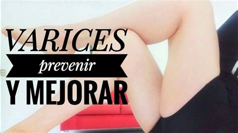 Ejercicios Para Varices YouTube