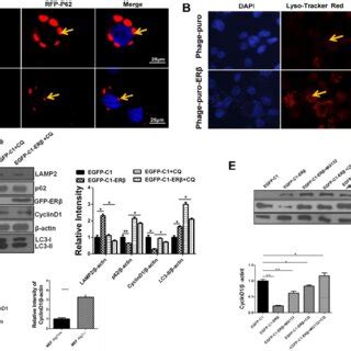 Er Mediated Autophagy Exerts An Anti Proliferation Role Through