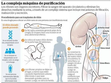 Informaci N Sobre El Trasplante Del Ri N Y Como Realizan El