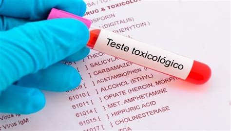 Exames Toxicol Gicos O Que Mudou E O Que Continua Dauar Medtra