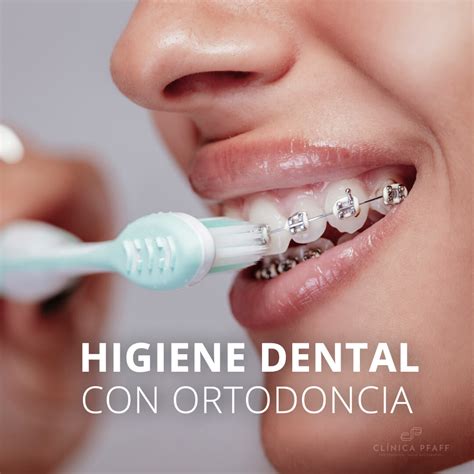 Importancia De La Higiene Dental Durante La Ortodoncia Cl Nica Dental