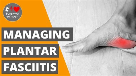 Managing Plantar Fasciitis YouTube