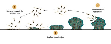 Bacteria And Biofilm Formation On Biomaterials